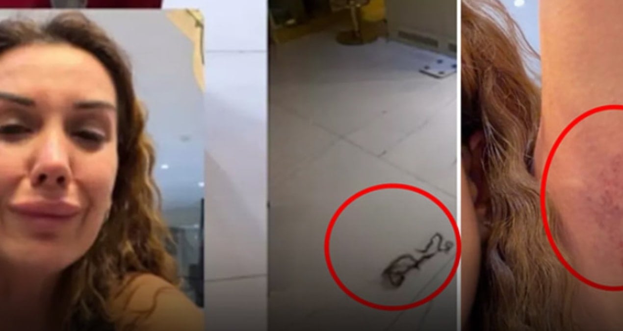 Dilan Polat en yakınından tekme tokat dayak yedi